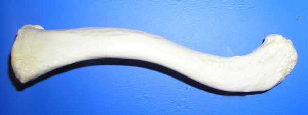 Soubor:Clavicula sup.jpg