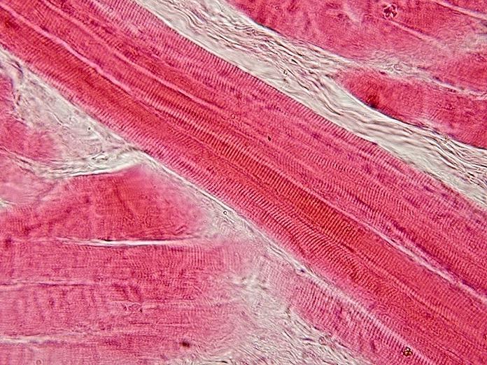 Soubor:Skeletal muscle - longitudinal section.jpg