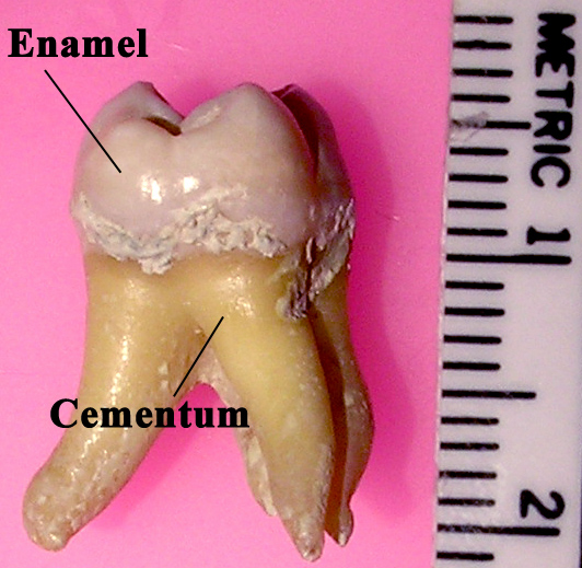 Soubor:Labeledmolar.jpg